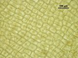 Dettaglio delle cellule corticali in visione superficiale